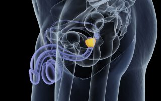 Spezialisierungen, Prostata, Prof. Dr. Michael Eisenmenger
